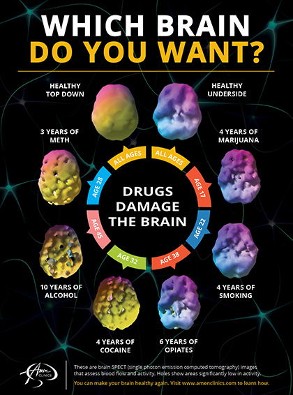 Which-Brain-Do-You-Want-420x566.jpg